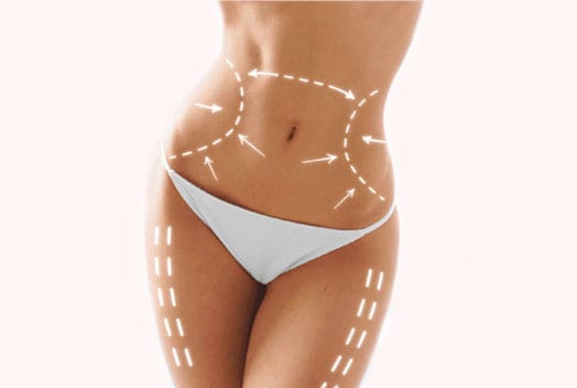 liposuction knoxville